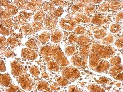 Immunohistochemistry-Paraffin: SAMD4B Antibody [NBP2-20255]