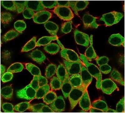 Immunocytochemistry/ Immunofluorescence: SAMD4B Antibody (PCRP-SAMD4B-1H3) [NBP3-13749]