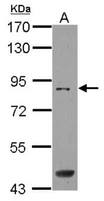 Western Blot: SAMD4B Antibody [NBP2-20255]