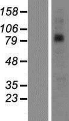 Western Blot: SAMD4B Overexpression Lysate [NBP2-06883]