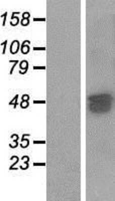 Western Blot: SAMD7 Overexpression Lysate [NBP2-04836]