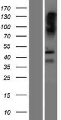 Western Blot: SAMD8 Overexpression Lysate [NBP2-10253]