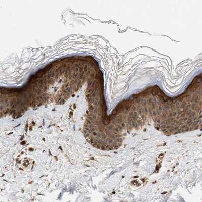Immunohistochemistry-Paraffin: SAMD9 Antibody [NBP1-91244]