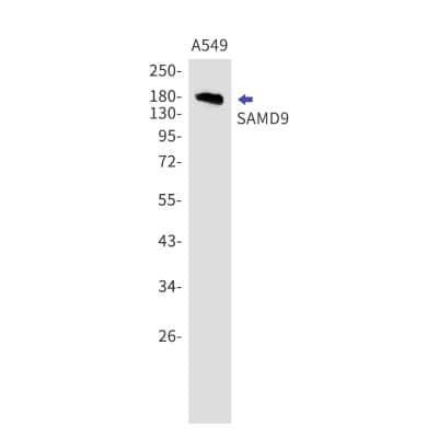 Western Blot: SAMD9 Antibody (S09-5B4) [NBP3-19767]