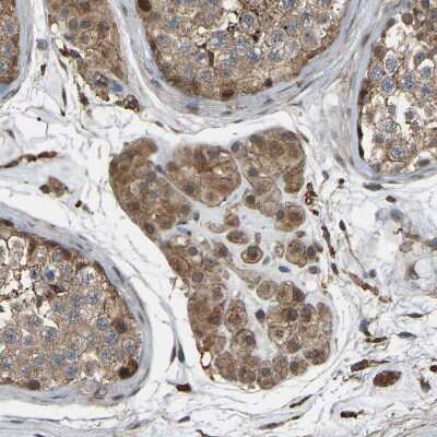Immunohistochemistry-Paraffin: SAMD9L Antibody [NBP1-91241]