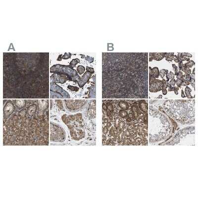 Immunohistochemistry-Paraffin: SAMD9L Antibody [NBP1-91241]