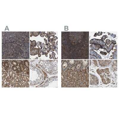 Immunohistochemistry-Paraffin: SAMD9L Antibody [NBP1-91242]