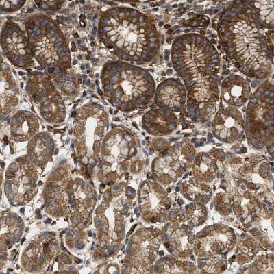 Immunohistochemistry-Paraffin: SAMD9L Antibody [NBP1-91242]