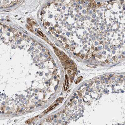 Immunohistochemistry-Paraffin: SAMD9L Antibody [NBP1-91242]