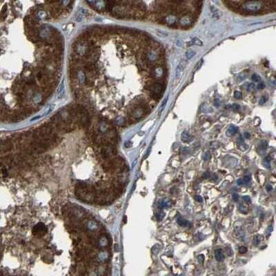Immunohistochemistry-Paraffin: SAMD9L Antibody [NBP1-91243]