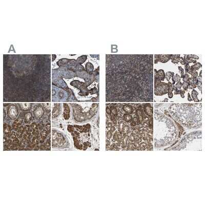 Immunohistochemistry-Paraffin: SAMD9L Antibody [NBP1-91243]