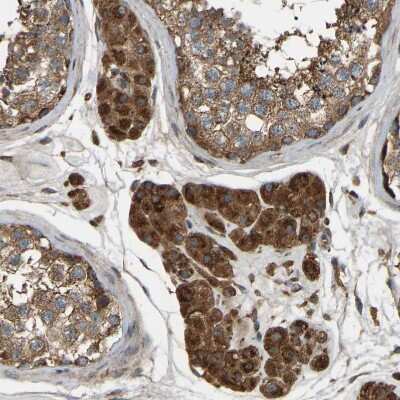 Immunohistochemistry-Paraffin: SAMD9L Antibody [NBP1-91243]