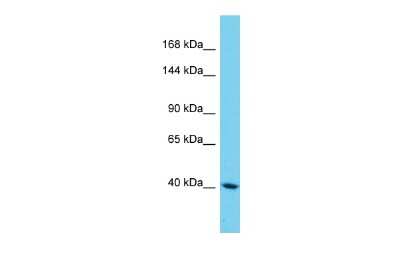 Western Blot: SAMD9L Antibody [NBP2-88209]