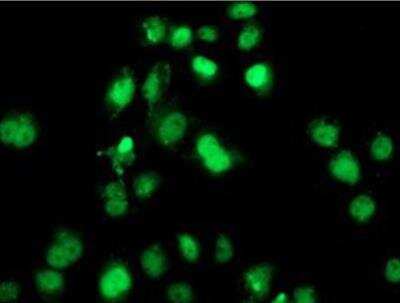 Immunocytochemistry/ Immunofluorescence: SAMHD1 Antibody (OTI3F5) [NBP2-03285]