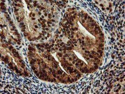 Immunohistochemistry-Paraffin: SAMHD1 Antibody (OTI3F5) [NBP2-03285]
