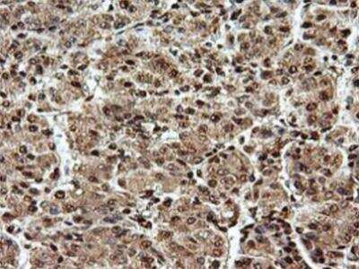 Immunohistochemistry-Paraffin: SAMHD1 Antibody (OTI3F5) [NBP2-03285]