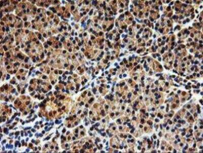 Immunohistochemistry-Paraffin: SAMHD1 Antibody (OTI3F5) [NBP2-03285]