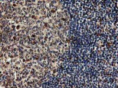 Immunohistochemistry-Paraffin: SAMHD1 Antibody (OTI3F5) [NBP2-03285]