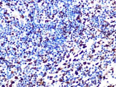 Immunohistochemistry-Paraffin: SAMHD1 Antibody (4C7B3) [NBP3-16448]