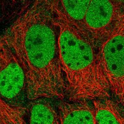 Immunocytochemistry/ Immunofluorescence: SAMHD1 Antibody [NBP2-47292]