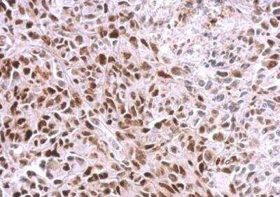 Immunohistochemistry-Paraffin: SAMHD1 Antibody [NBP1-31432]