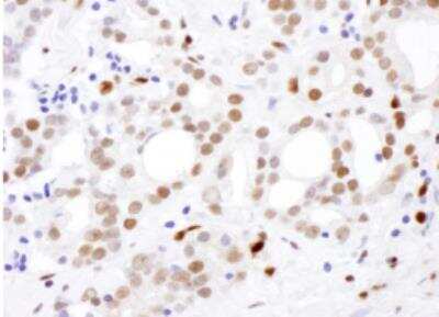 Immunohistochemistry-Paraffin: SAMHD1 Antibody [NBP2-12776]