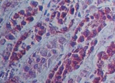 Immunohistochemistry-Paraffin: SAMHD1 Antibody [NBP2-27097]