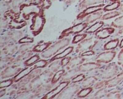 Immunohistochemistry-Paraffin: SAMHD1 Antibody [NBP2-27410]