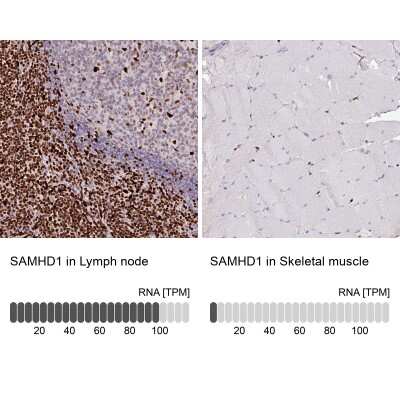 Immunohistochemistry-Paraffin: SAMHD1 Antibody [NBP2-47292]