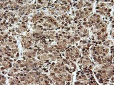 Immunohistochemistry: SAMHD1 Antibody (OTI3F5) - Azide and BSA Free [NBP2-73979]
