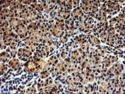 Immunohistochemistry: SAMHD1 Antibody (OTI3F5) - Azide and BSA Free [NBP2-73979]