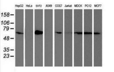 Western Blot: SAMHD1 Antibody (OTI3F5)Azide and BSA Free [NBP2-73979]