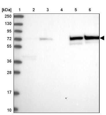 Western Blot: SAMHD1 Antibody [NBP2-47292]