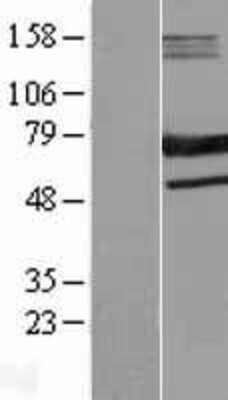 Western Blot: SAMHD1 Overexpression Lysate [NBL1-15682]