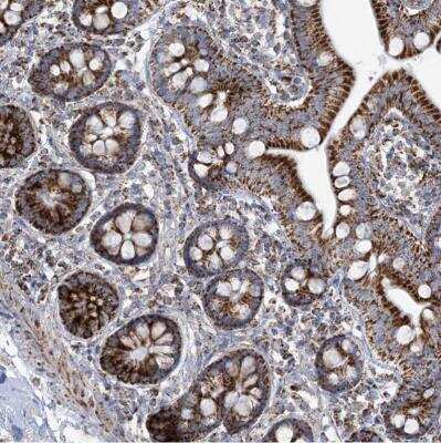 Immunohistochemistry-Paraffin: SAMM50 Antibody [NBP1-84509]