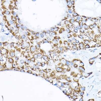 Immunohistochemistry-Paraffin: SAMM50 Antibody - BSA Free [NBP2-94852]