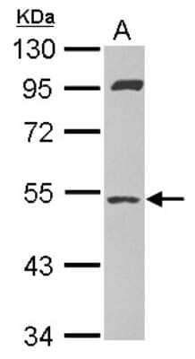 Western Blot: SAMM50 Antibody [NBP2-20257]