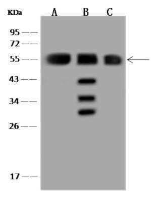 Western Blot: SAMM50 Antibody [NBP3-06283]