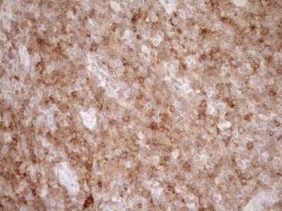 Immunohistochemistry: SAMSN1 Antibody (OTI7F5) [NBP2-45685]