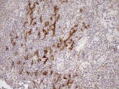 Immunohistochemistry: SAMSN1 Antibody (OTI7F5) [NBP2-45685]
