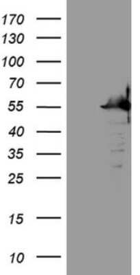 Western Blot: SAMSN1 Antibody (OTI7F5) [NBP2-45685]