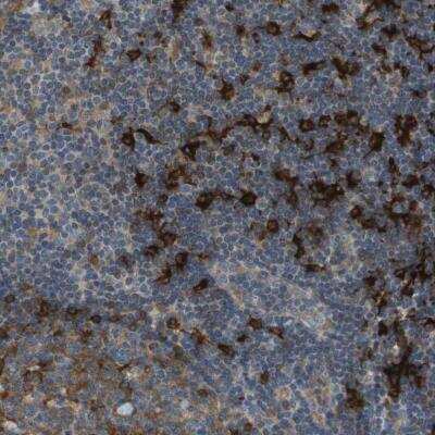 Immunohistochemistry-Paraffin: SAMSN1 Antibody [NBP1-82598]