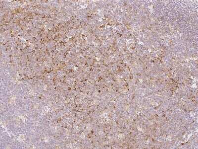 Immunohistochemistry-Paraffin: SAMSN1 Antibody [NBP2-97172]