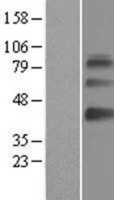 Western Blot: SAMSN1 Overexpression Lysate [NBL1-15684]