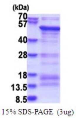 SDS-PAGE: Recombinant Human SAMSN1 His Protein [NBP2-51737]