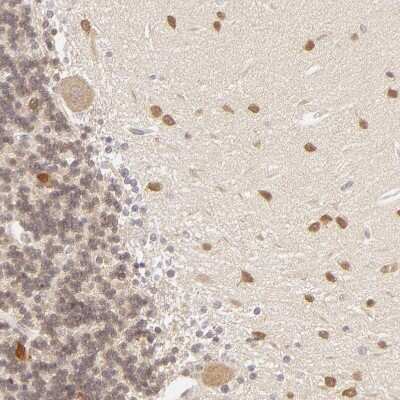 Immunohistochemistry-Paraffin: SAP102 Antibody [NBP1-87691]