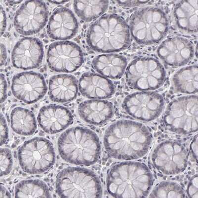 Immunohistochemistry-Paraffin: SAP102 Antibody [NBP1-87691]