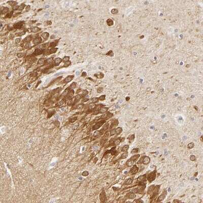 Immunohistochemistry-Paraffin: SAP102 Antibody [NBP1-87691]