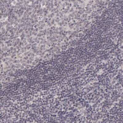 Immunohistochemistry-Paraffin: SAP102 Antibody [NBP1-87691]