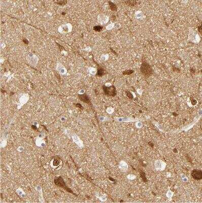 Immunohistochemistry-Paraffin: SAP102 Antibody [NBP1-87691]